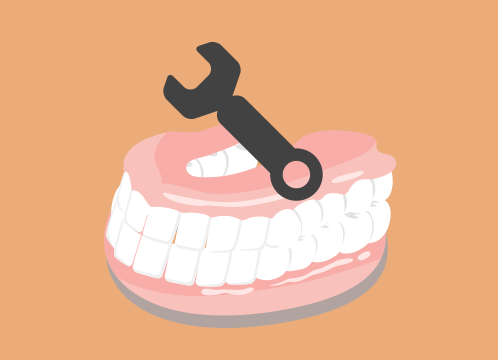 図解：入れ歯の調整のイラスト