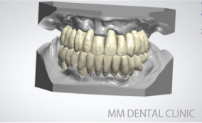 歯と歯並びのシュミレーション