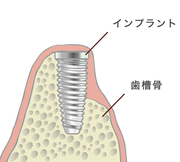 GBR工程1