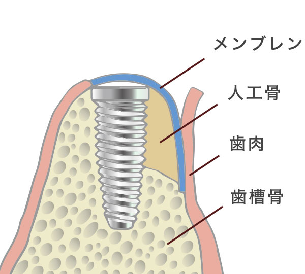 GBR工程2