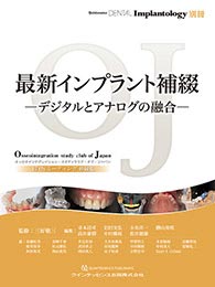 最新インプラント補綴 ―デジタルとアナログの融合―