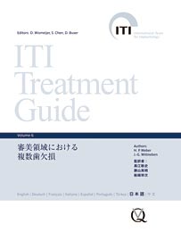 ITI Treatment Guide Volume 6 審美領域における複数歯欠損