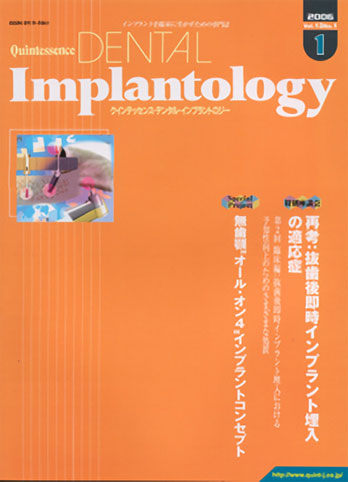 Quintessence DENTAL Implantology 2006年No.1