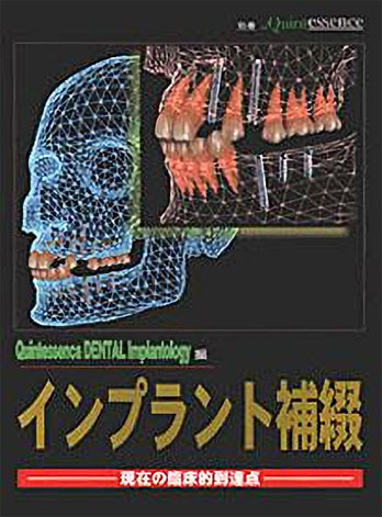 別冊ザ・クインテッセンス　インプラント補綴　現在の臨床的到達点